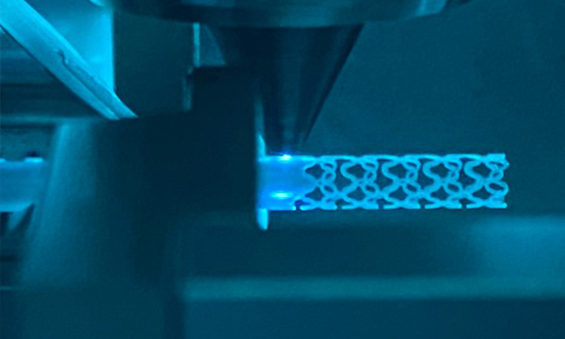 Laser processing of a biodegradable stent